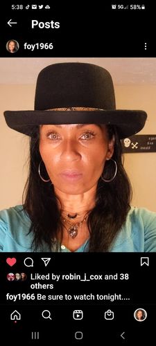 Customer photo review of Norko Brown Contact Lenses(12 months wear)