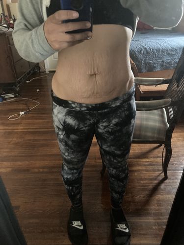 Customer photo review of AWAKEN: Skin Repair Intensive Healing Serum