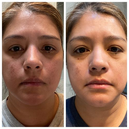 Customer photo review of Complete Skin Perfecting Body Bundle