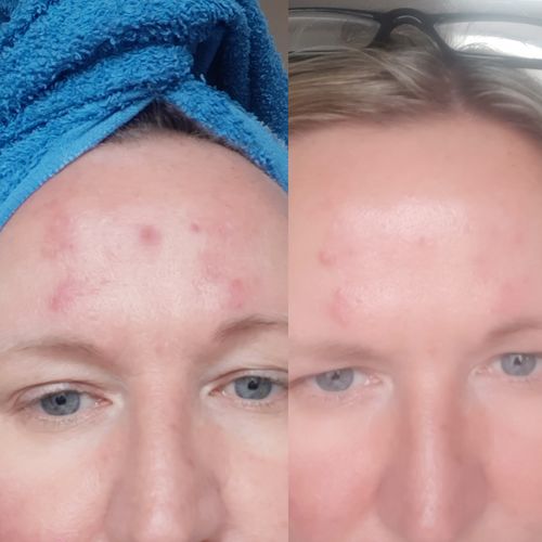 Customer photo review of Radiance Powder