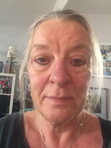 Customer photo review of Rosalique 3 in 1 Anti-Redness Miracle Formula SPF50