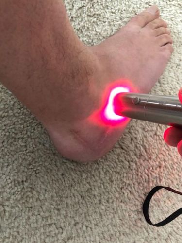 Customer photo review of ClinicRed Fototerápiás Eszköz