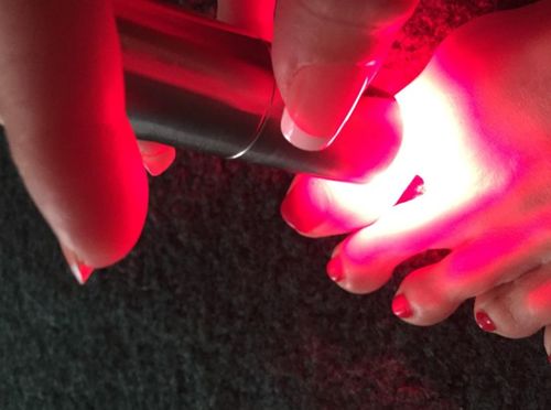 Customer photo review of ClinicRed Fototerápiás Eszköz