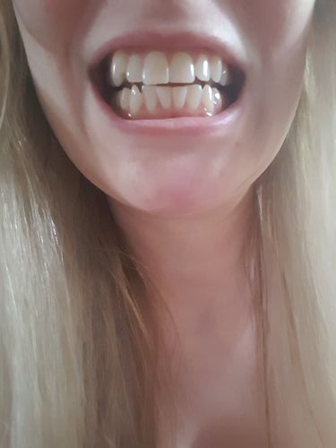 Customer photo review of CocoStrips