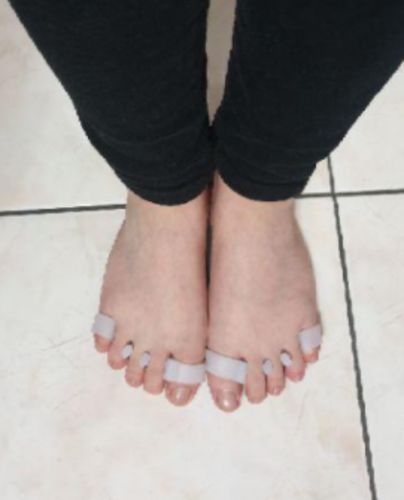 Customer photo review of BODYFEET ALIGNERS KIT