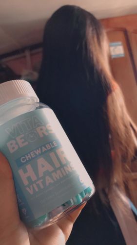 Customer photo review of Skin Vitamin Gummies