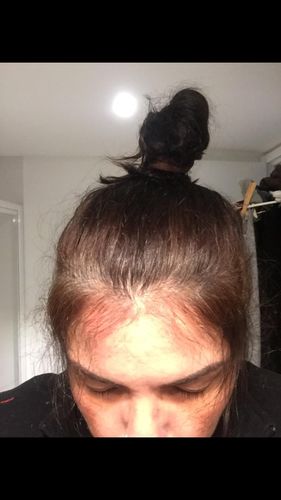 Customer photo review of Good Hair Vitamins - 3 mois
