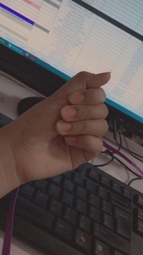 Customer photo review of Flawless Beauty Gummies