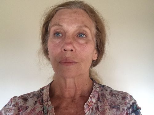 Customer photo review of Beginner's Set - Normal - Dry Skin 10.00% Off Auto renew (Ships every 2 Months)