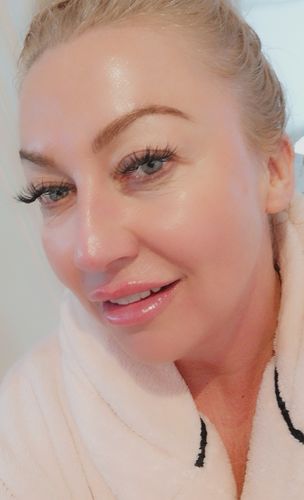 Customer photo review of K Ceutic (Spf 50)