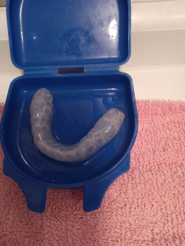 Customer photo review of SleepPro Standard Plus Night Guard 3mm