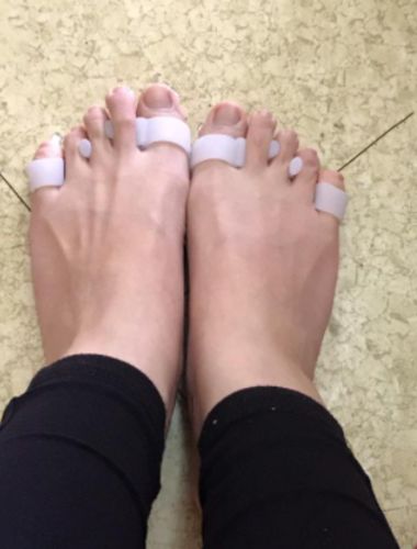 Customer photo review of BODYFEET ALIGNERS KIT