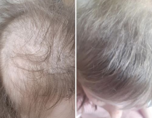 Customer photo review of Inches - Hair & Beard Oil