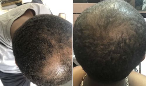 Customer photo review of Inches - Hair & Beard Oil