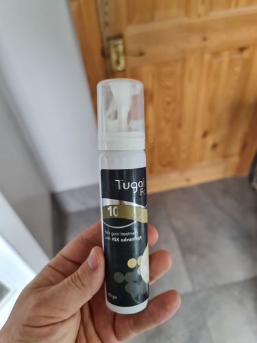 Customer photo review of 10% Tugain Foam Minoxidil Extra Strength Hair Regrowth for Men.