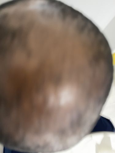 Customer photo review of Inches - Hair & Beard Oil