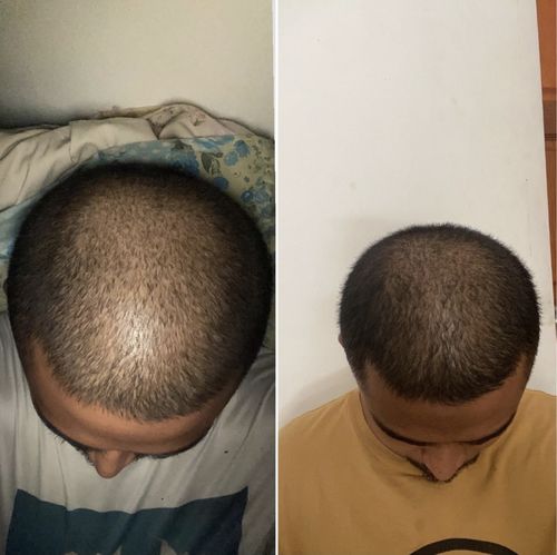Customer photo review of Origin
