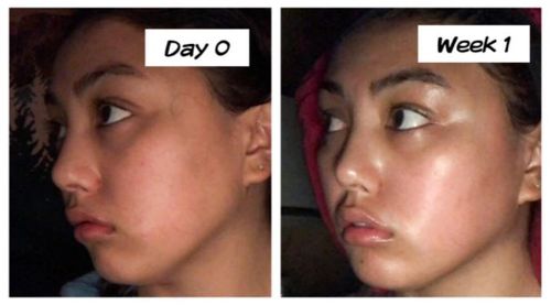 Customer photo review of The De-Puffing Facial Roller