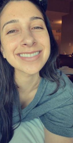 Customer photo review of The De-Puffing Facial Roller