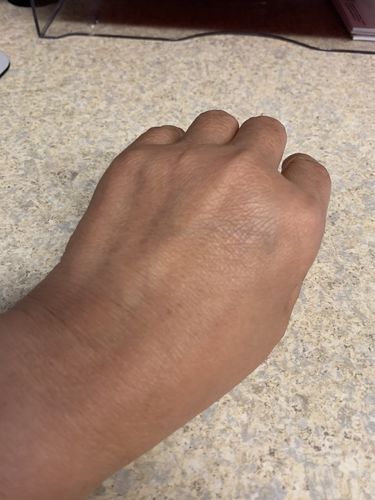 Customer photo review of Lumina Hand Treatment™