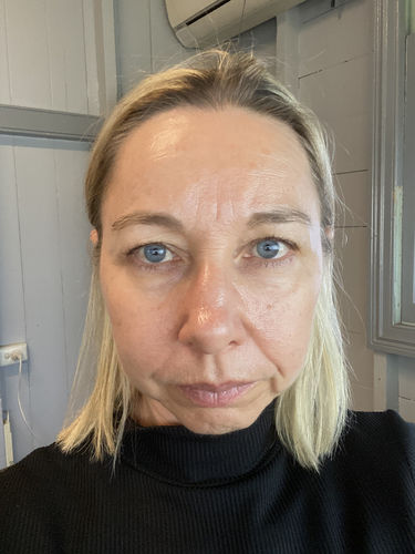 Customer photo review of Facial Cleansing Brush