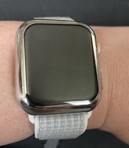 Customer photo review of Glossy Case for the Apple Watch