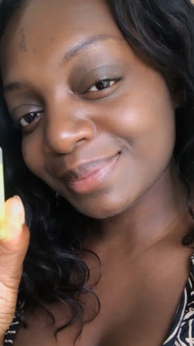 Customer photo review of Ice Therapy Roller