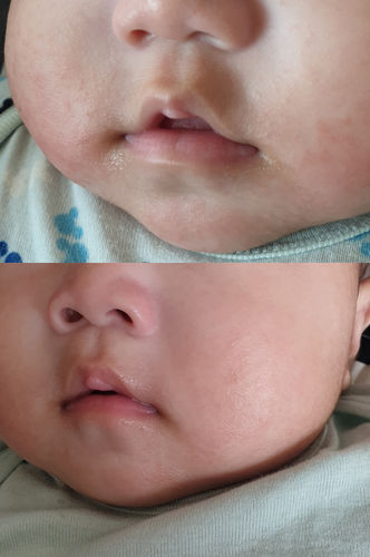 Customer photo review of Coco 全方位護膚套裝 (濕疹修護霜+護膚乳霜+洗髮沐浴護膚露)