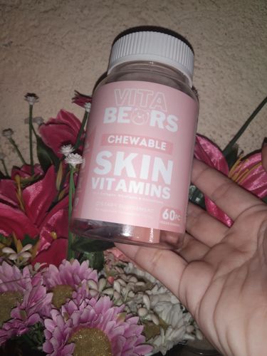 Customer photo review of Skin Vitamin Gummies