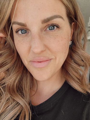 Customer photo review of Freckle Stain