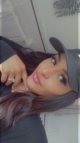 Customer photo review of LipFix: Filler