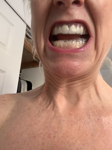 Customer photo review of 14 Day Special Offer