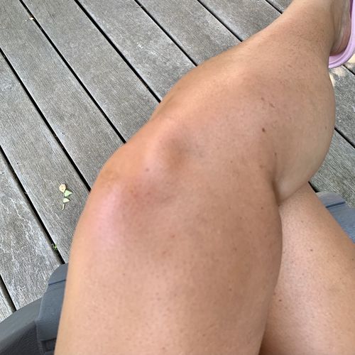 Customer photo review of Mousse autobronzante