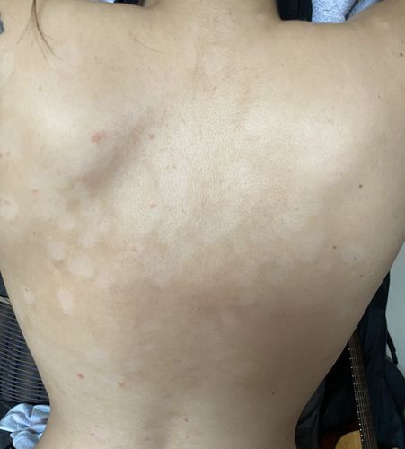 Customer photo review of Skin Saviour Balm