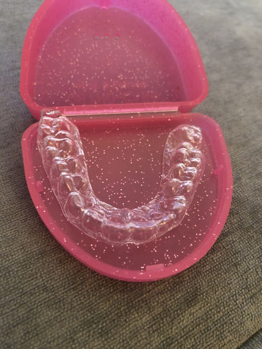 Customer photo review of SleepPro Retainers