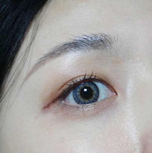 Customer photo review of Catchy Gray (1pcs) (Buy 1 Get 1 Free) 3Monthly G.DIA 13.4mm