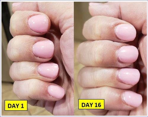 Customer photo review of GHDip Dip Powder Nail Kit G641 (Pink&White French Nail Colors)