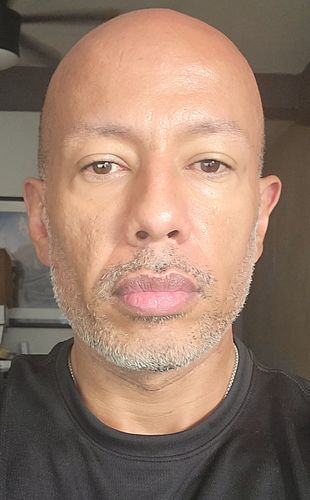 Customer photo review of EyeFix: Filler