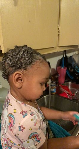 Customer photo review of Kid's Hair Growth Scalp Stimulator