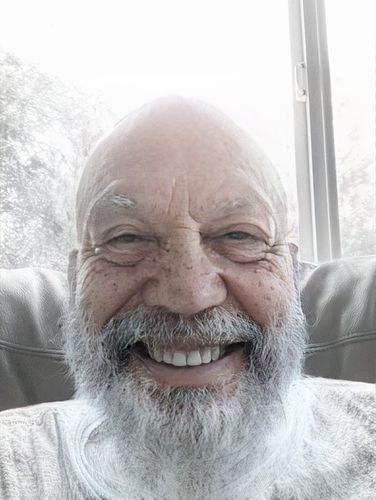 Customer photo review of 12.5% Minoxidil Extra Strength Topical Solution USP for Men.