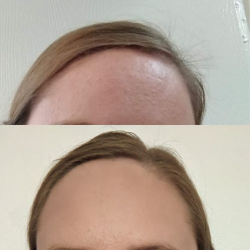 Customer photo review of Cleanser