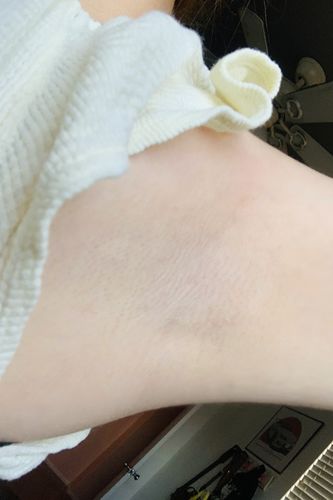 Customer photo review of Starter Honey Kit