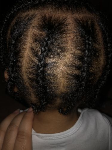 Customer photo review of Kid's Super healthy Hair kit