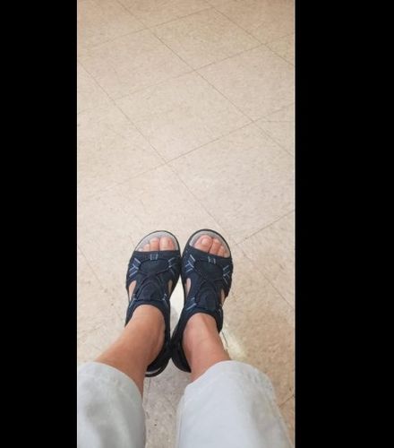 Customer photo review of Women's Soft Adjustable Sandals, Orthotic Plantar Fasciitis Arch Support Sandals for Flat Feet