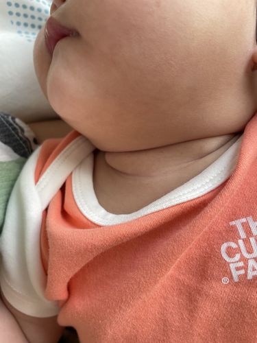 Customer photo review of Coco 濕疹修護霜套裝