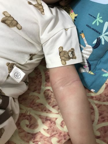 Customer photo review of Coco 全方位護膚套裝 (濕疹修護霜+護膚乳霜+洗髮沐浴護膚露)