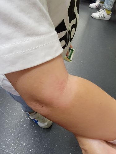 Customer photo review of Coco 濕疹修護霜 80ml