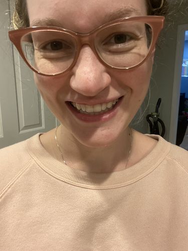 Customer photo review of File Your Smile (A Digital Record Of Your Teeth For Future Orders)