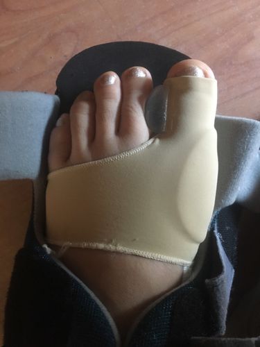 Customer photo review of Manchon orthopédique pour oignons