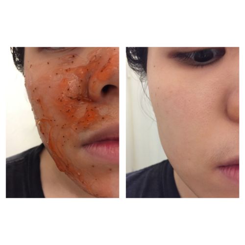 Customer photo review of POMEGRANATE INSTANT CALMING MASK